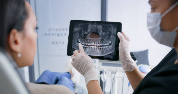 Licensed Tooth Extraction service in Maywood, NJ - Smile Center Dentistry